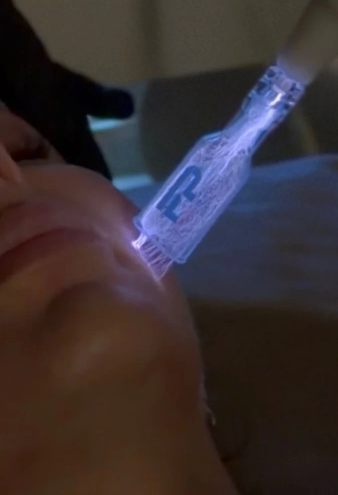 fusion-plasma-needling-with-pdrn