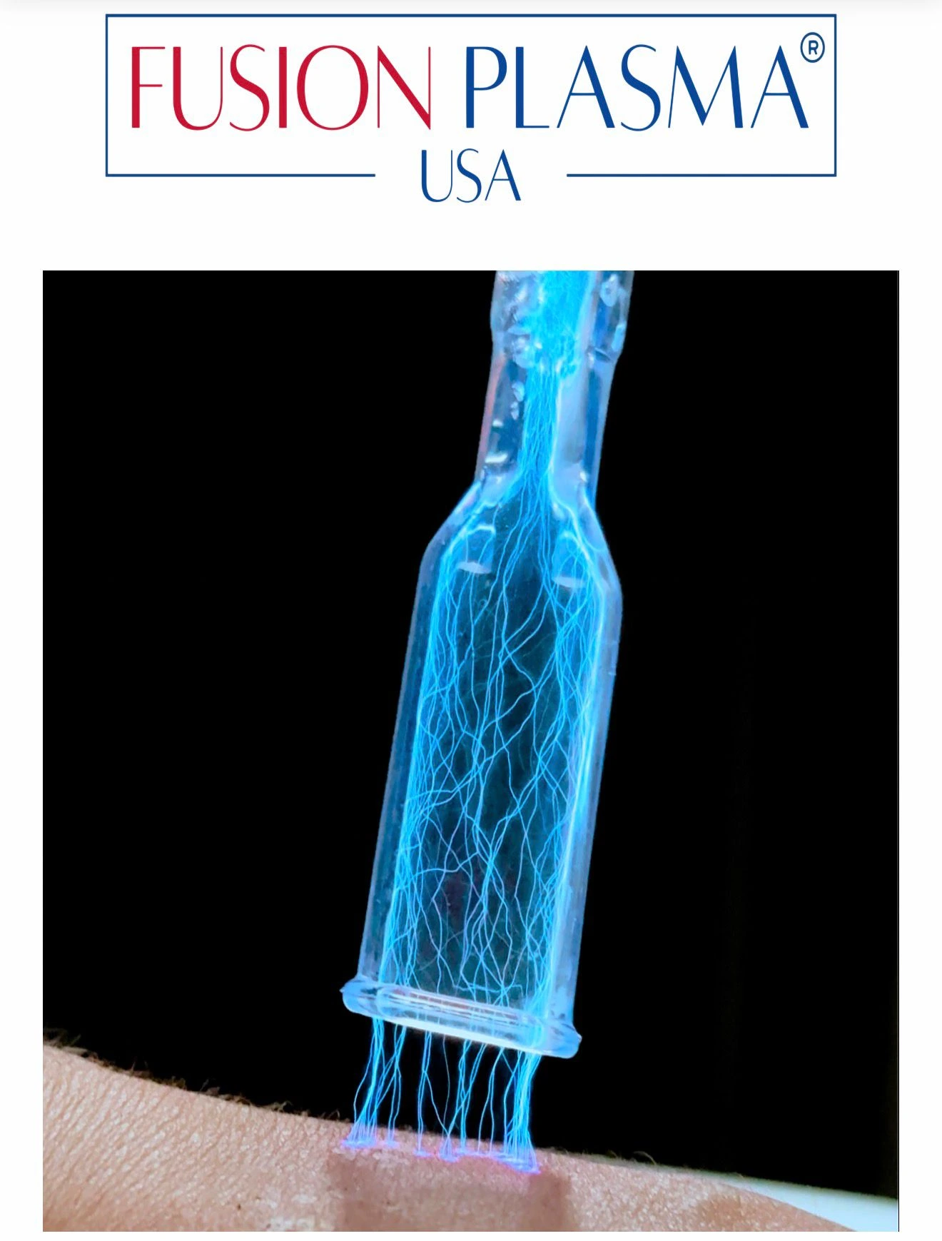 fusion-plasma-lifting-resurfacing-treatment