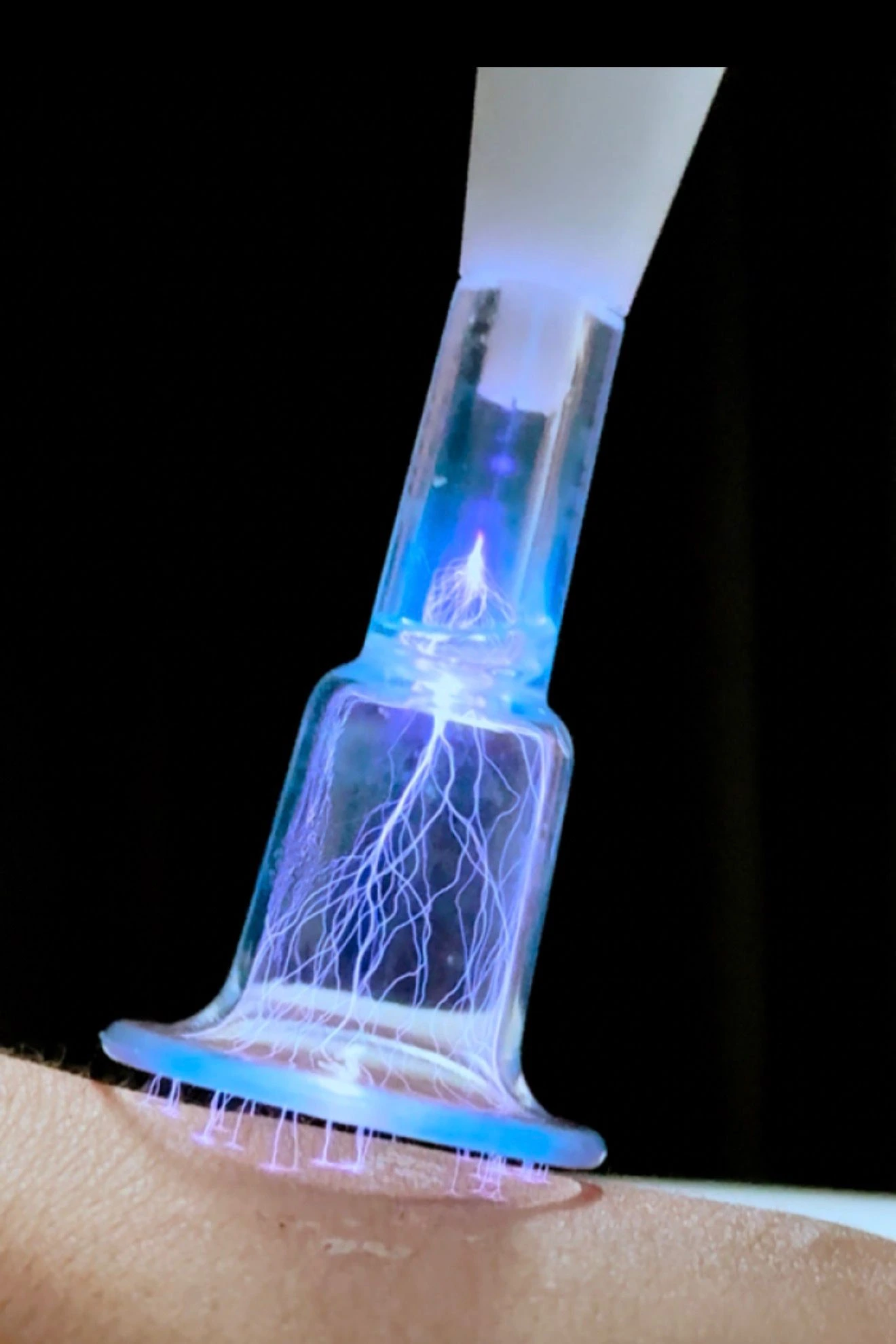 fusion-plasma-lipocellulite-treatment