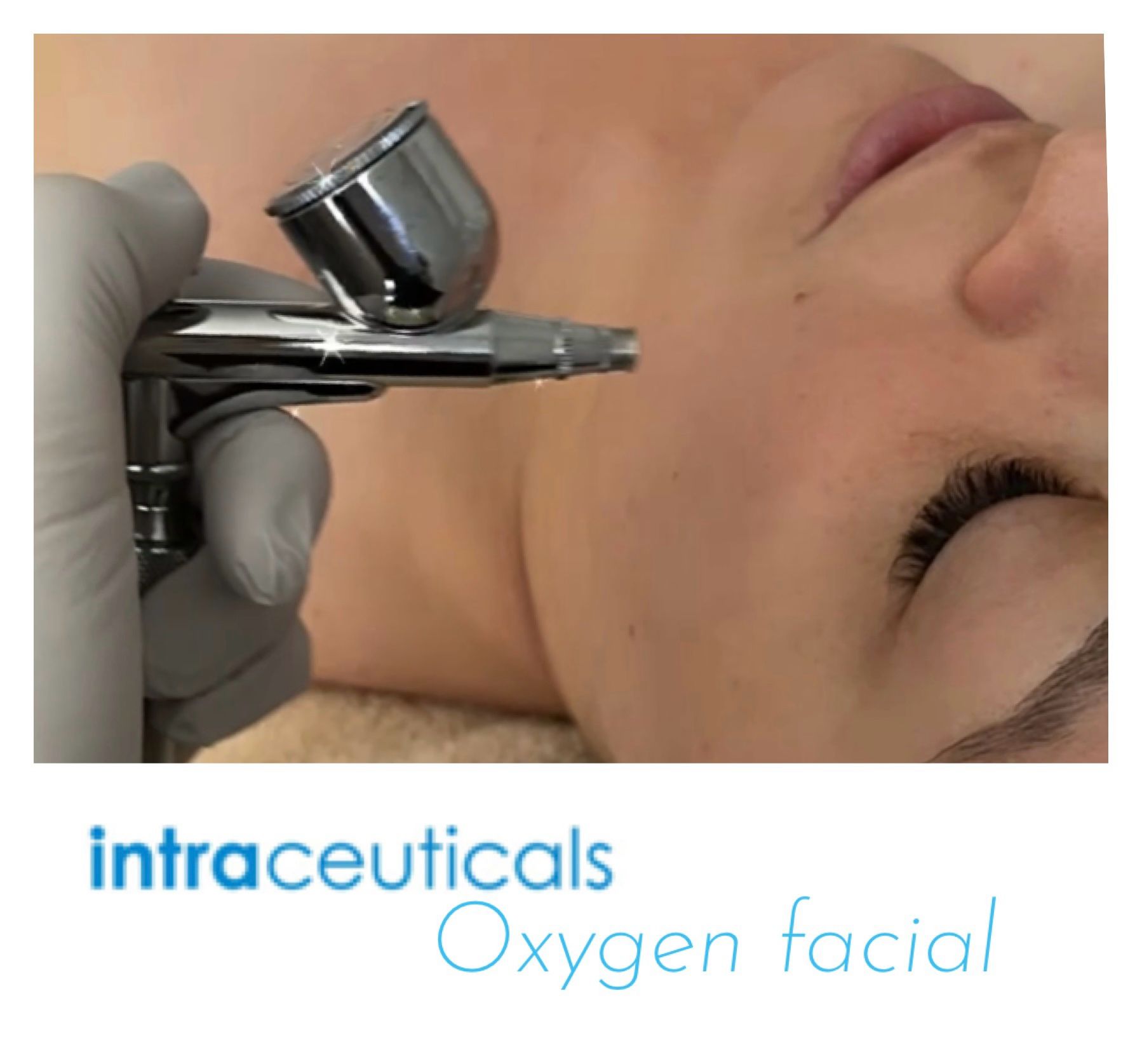 oxygen-facial